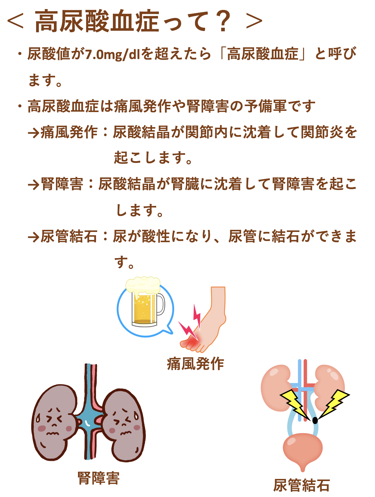 高尿酸血症 痛風 にしだ 内科 外科クリニック